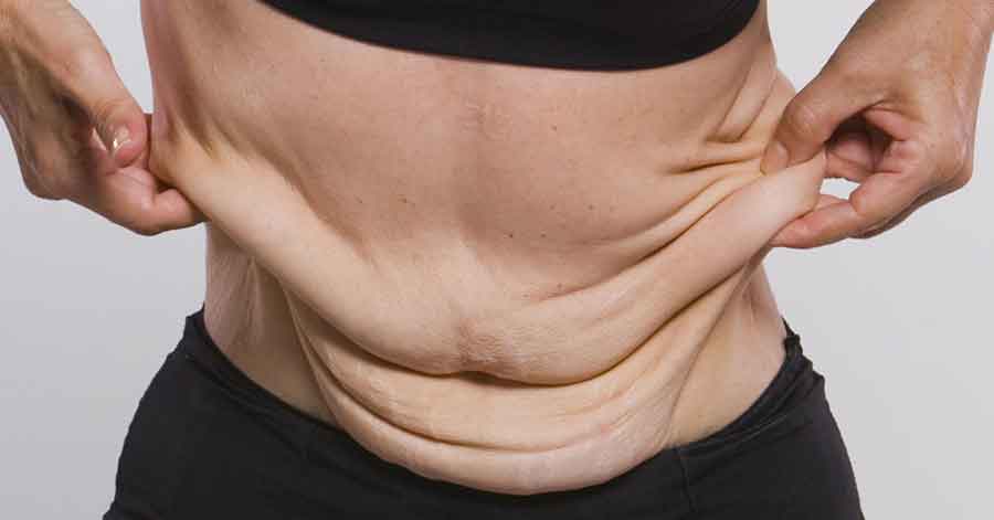 لیست مراکز لیپوماتیک و لیپوساکشن در کرج